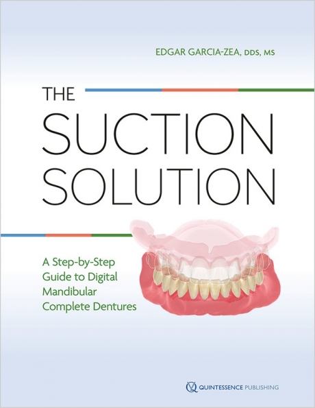 The Suction Solution: A Step-by-Step Guide to Digital Mandibular Complete Dentures