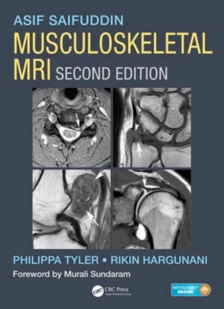 Musculoskeletal MRI 2nd Edition
