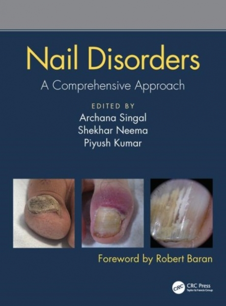 Nail Disorders  A Comprehensive Approach