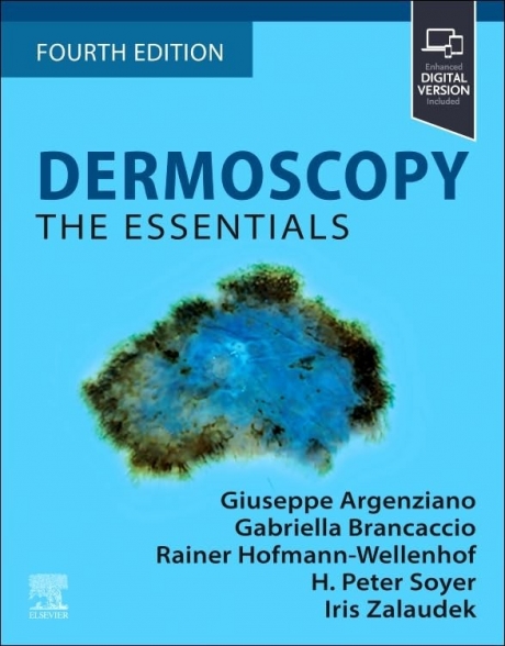 Dermoscopy: The Essentials, 4th Edition