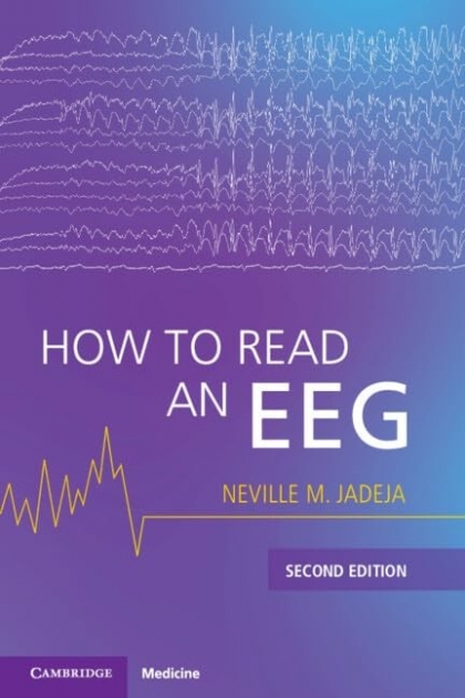 How to Read an EEG, 2nd Edition