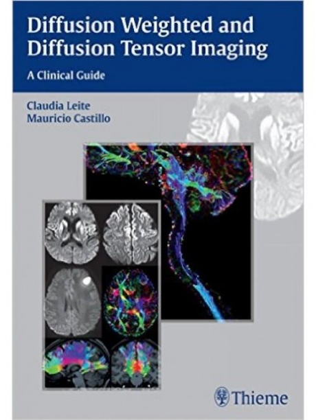 Diffusion Weighted and Diffusion Tensor Imaging: A Clinical Guide