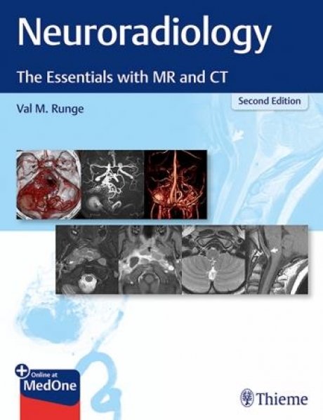 Neuroradiology: The Essentials with MR and CT, 2nd Edition