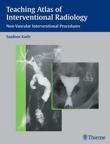 Teaching Atlas of Interventional Radiology: Non-vascular interventional procedures