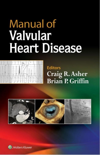 Manual of Valvular Heart Disease