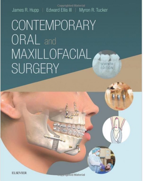 Contemporary Oral and Maxillofacial Surgery, 7th Edition